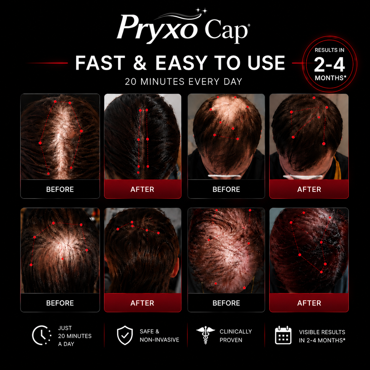 Proxy™ Red Light Therapy Hair Regrowth Cap
