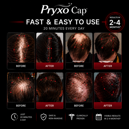 Proxy™ Red Light Therapy Hair Regrowth Cap
